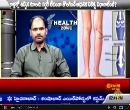 Varicose Veins Video by Dr.M.V.Chalapathi Rao